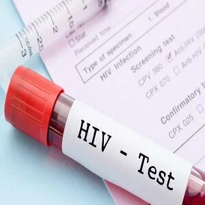 Nigeria: Over 2m Youth are Ignorant of their HIV status -Data